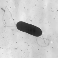 Snohomish County resident first in state to be affected by nationwide listeria outbreak