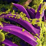 New Mexico Man Diagnosed With Plague In State's First Case This Year, Say Officials
